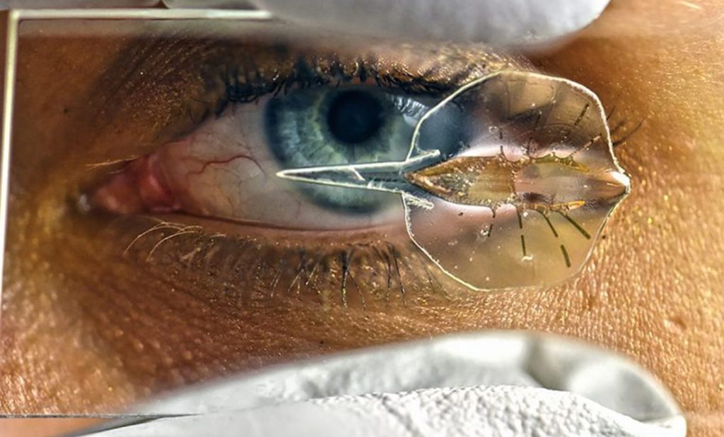 Scientists grow a biohybrid creature using 3D printed heart muscle and gold