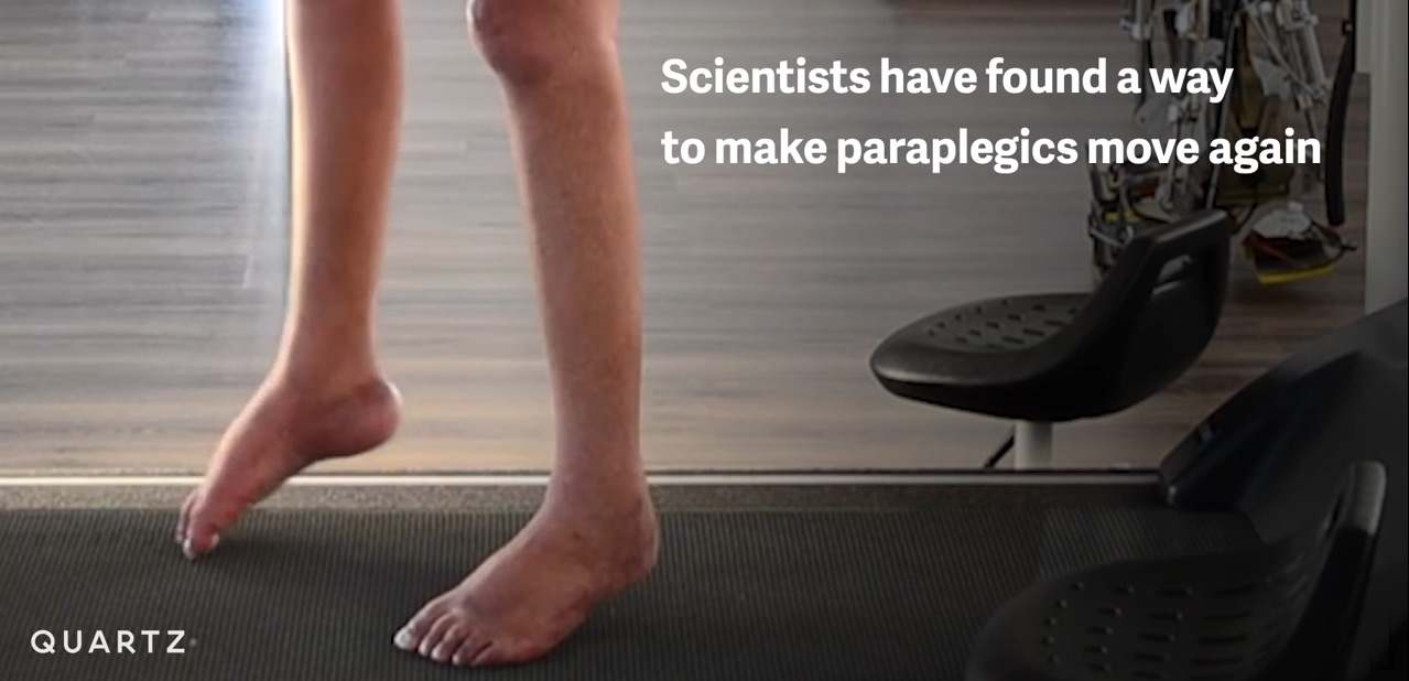 Virtual Reality can help train paraplegics to regain movement and walk again